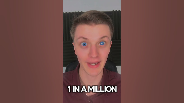 People Who Are 1 In A Million