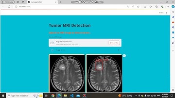 Brain MRI Tumor Detection