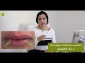 تصحيح تكتلات الشفايف مع الدكتورة رغد القيسي Fixing Lip Filler Lumps And Bumps 