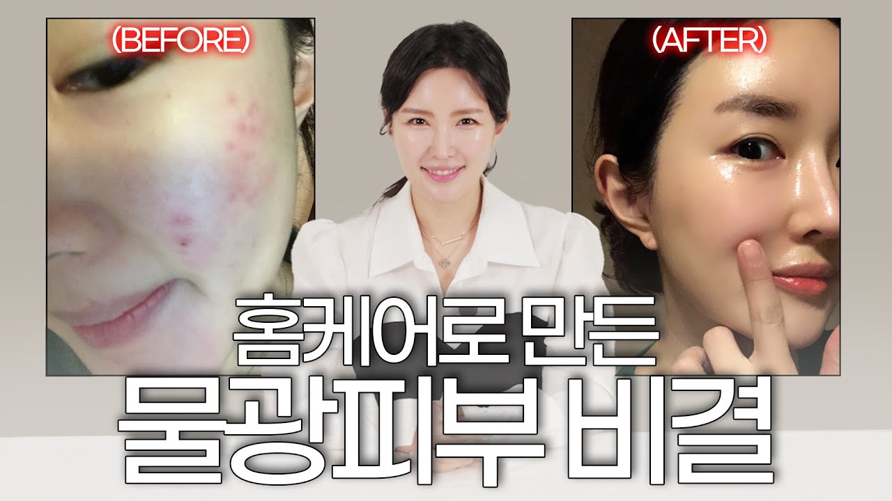 광고❌시술❌ 집에서 쉽게 따라할 수 있는 물광피부 비결✨
