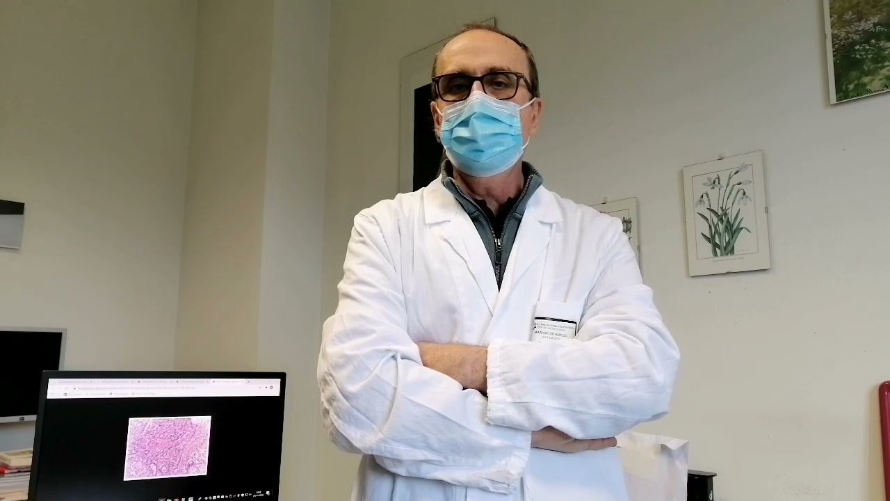 Fibre di amianto nei tessuti tumorali: stato della ricerca