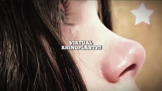 Exclusive I NEVER saw such a beautiful nose as urs…. u sure u DIDN’T get a nose job?!?!?! 😨😨 Details