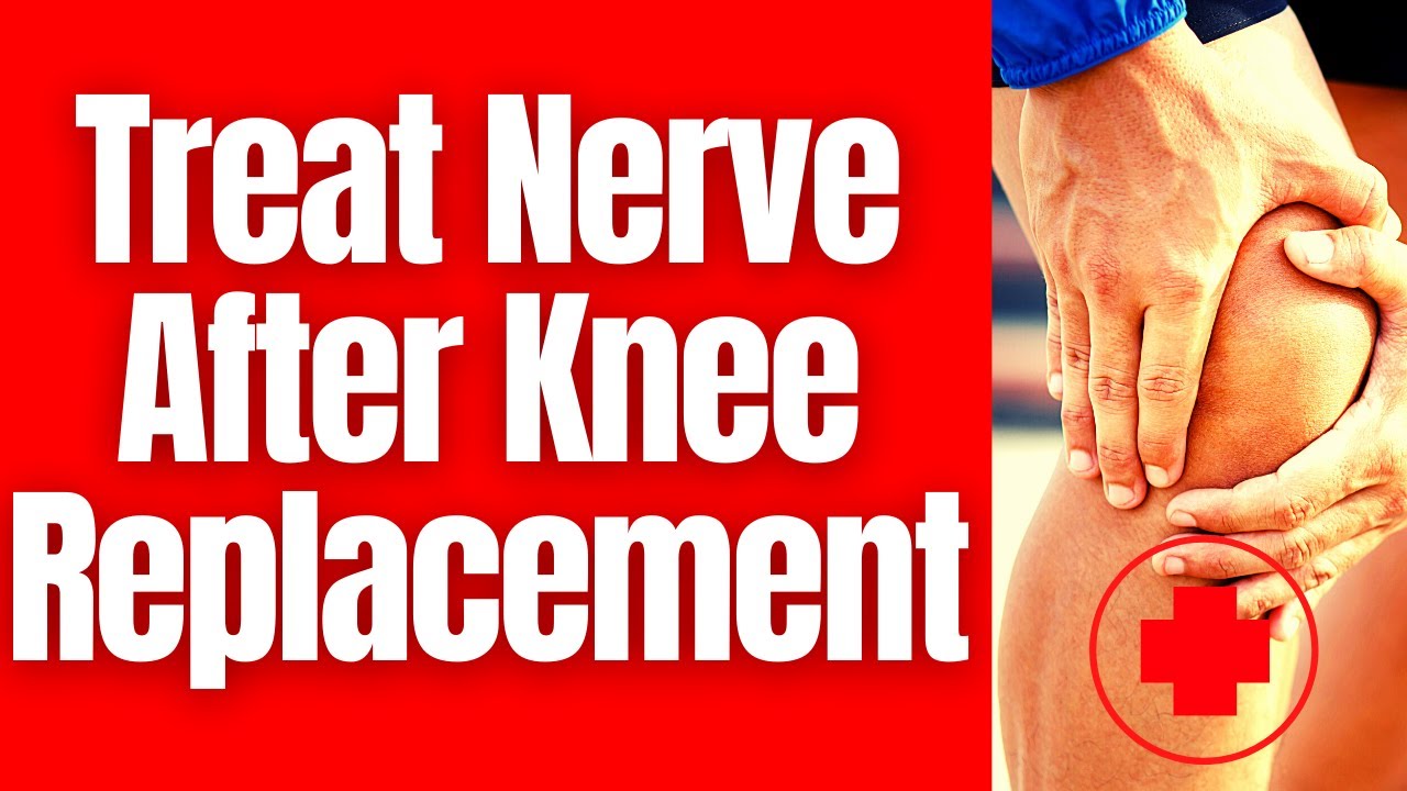 How To Treat Nerve Pain After Knee Replacement ️ www.EaseKneePain.com # ...