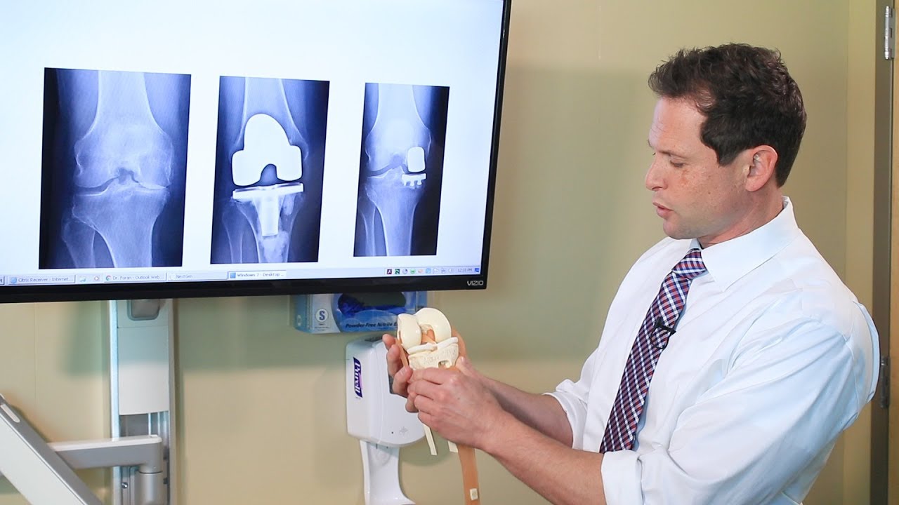 Partial Knee Replacement - A Total Solution for a Partial Problem - YouTube