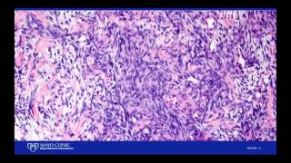 Cases With Dr. Keeney: Case #1