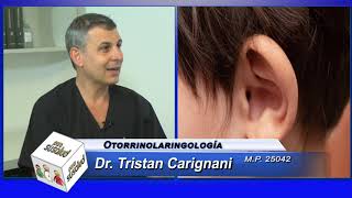 Cirugía reconstructiva del pabellón auricular ¿en que casos?  Dr  Tristan Carignani   20 03 2021