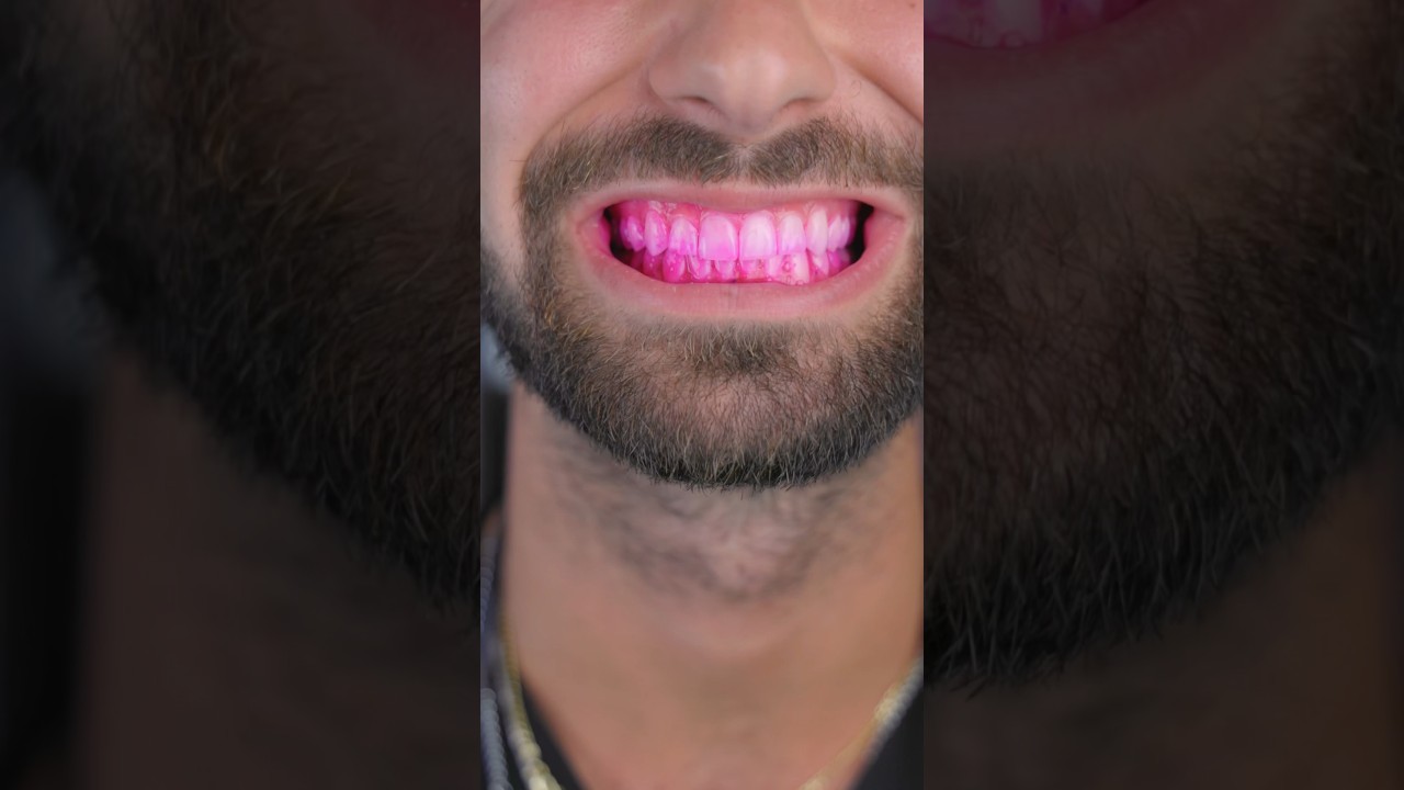 зубная щетка usmile 