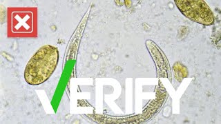 Verify: No, healthy Americans do not need to take deworming medicine