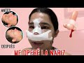 Me operé la nariz 👃 Toda mi experiencia | Jansy Arencibia #rinoplastia #cirugia