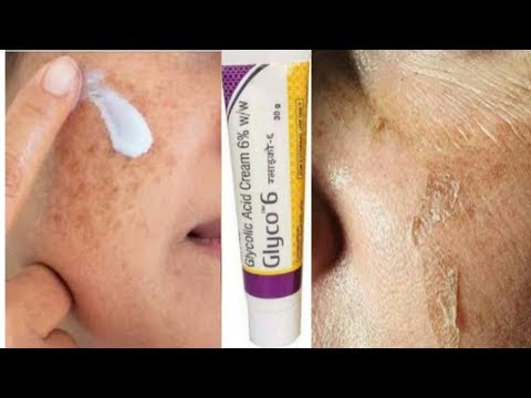 Glyco -6 Cream | glycolic acid | Remove pigmentation | Acne Scars | pimple marks |