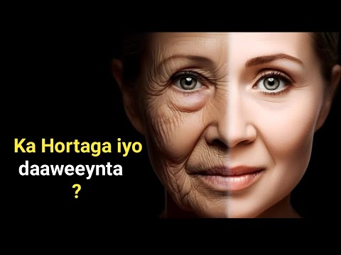 Si Dabiici Ah U Daaweey Haaraha Gad Gaduudka Qaleelka Finanaka Wijiga Iyo Duuduubka 