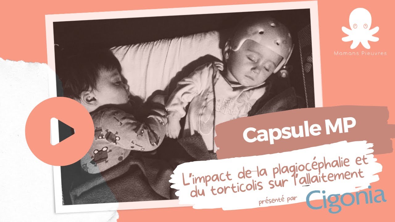 L’impact de la plagiocéphalie et du torticolis sur l’allaitement, par Cigonia