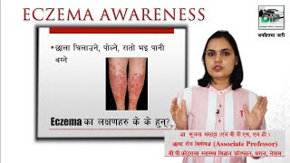 Eczema in Nepali | राेइरहेकाे छाला | छाला राेग विशेषज्ञ | Dr. Suchana Marahatta | DIP नेपाली