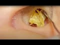 ASMR：目で感じる耳掃除、これが新しい快感。