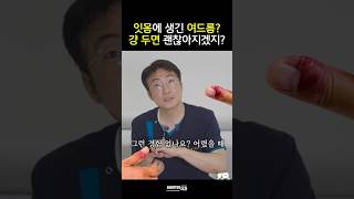 잇몸 고름주머니 그냥 두면 생기는 일 #물집