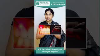 Loose Teeth? Save Them with Advanced Gum Treatments! | LBR Dental