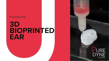 3D Bioprinted Ear