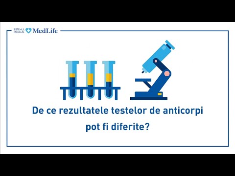 Video: Cum Să Aflați Rezultatele Testării De încercare