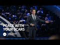 Joel Osteen - Peace With Your Scars