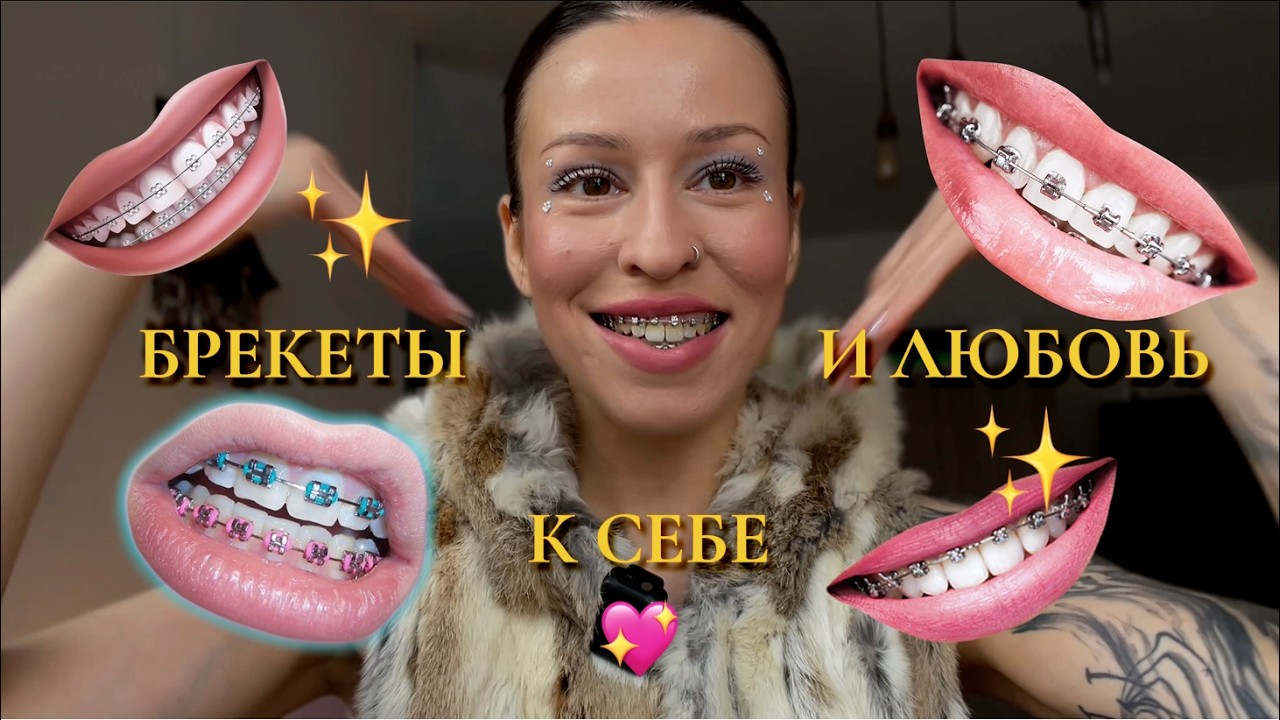 Мой путь ношения брекетов, внутренние изменения и преображения, избавление от главного комплекса 💖