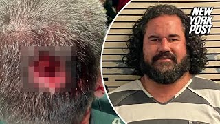 Drugged-out Florida man arrested after biting off piece of cop’s head at music festival