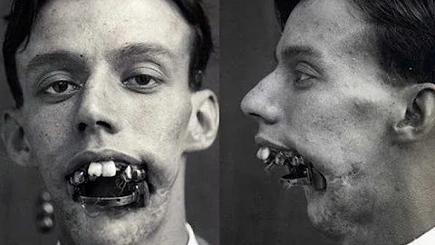 15 Creepy Vintage Medical Photos - DayDayNews