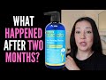 HAIR LOSS SUFFERER TESTS PURA D'OR ANTI THINNING THERAPY SHAMPOO 8 WEEK REVIEW WITH BEFORE AND AFTER