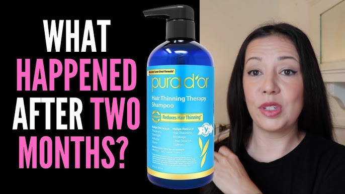 PURA D'OR Biotin Shampoo and Conditioner Review- Does it prevent Thinning  Hair? 