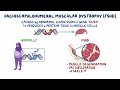 Facioscapulohumeral muscular dystrophy (Year of the Zebra)
