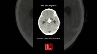 Brain CT Question 39