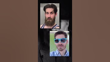 Do You Have A Patchy Beard? Check Out These Beard Transformations. #shorts