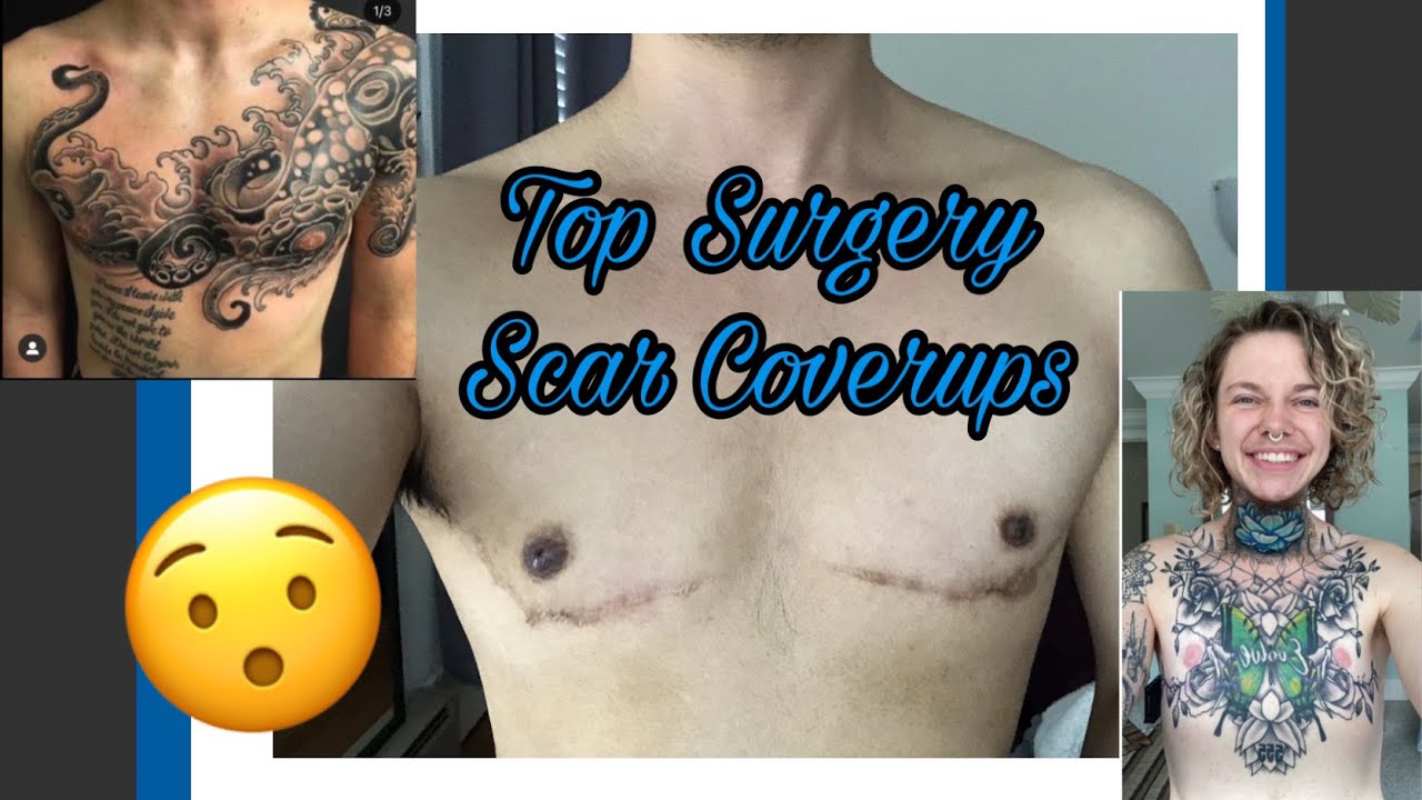 TopSurgery Scars Types Scar Treatments CoverUp Tattoos  POPSUGAR  Beauty