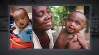 Elisabeth's Story | Mercy Ships