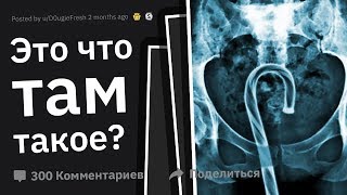 Врачи Рассказывают о ХУДШИХ Травмах из-за Ceк$@ #2