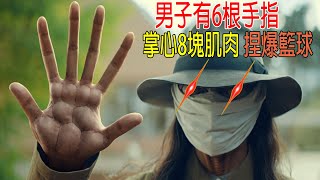 男子6根手指，掌心8塊肌肉，能捏爆籃球！戰鬥力10萬以上