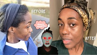 I Used a LED Light Therapy Mask Every Day For 6 Weeks & This Is What Happened!