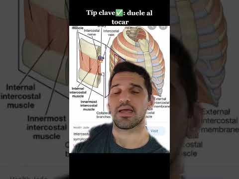 Video: ¿Puede un nervio pellizcado causar dolor en el pecho?