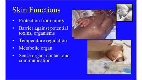 Carolyn Lund on Neonatal Skin Care