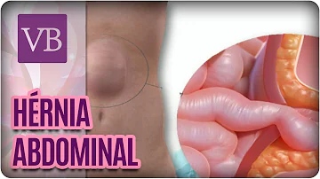 Como surge uma hérnia abdominal?