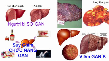 Cây AN XOA - Những AI TUYỆT ĐỐI KHÔNG NÊN DÙNG cây AN XOA để chữa bệnh