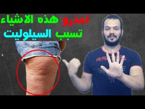  أكلات و مشروبات تسبب السيلوليت و تزيد من شدته اذا كان موجود