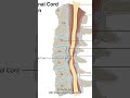 Neck Pain from Cervical Discs | Causes, Symptoms & Support Options | Dr. Arkam Rehman – Jacksonville