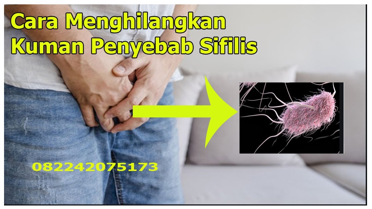 Penularan Sifilis Pada Wanita Mobil Motor Terbaru Berita Review Panduan Membali Gambar Dan Lebih