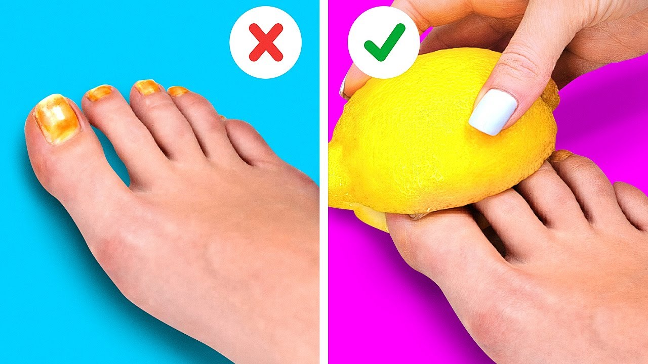 FEET HACKS AND COOL SHOE CRAFTS YOU SHOULD TRY