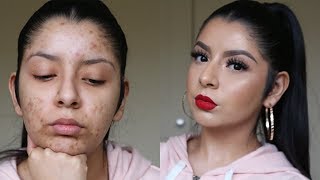 Flawless Glowing Full Coverage Foundation Routine | Zoey