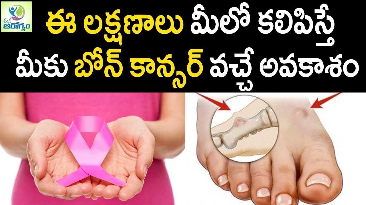 Cancer Definition In Telugu Doctor Heck