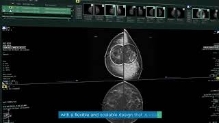 Fujifilm Healthcare: SYNAPSE PACS