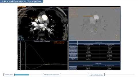 Philips IntelliSpace Portal 7.0 - MR Cardiac Viewing