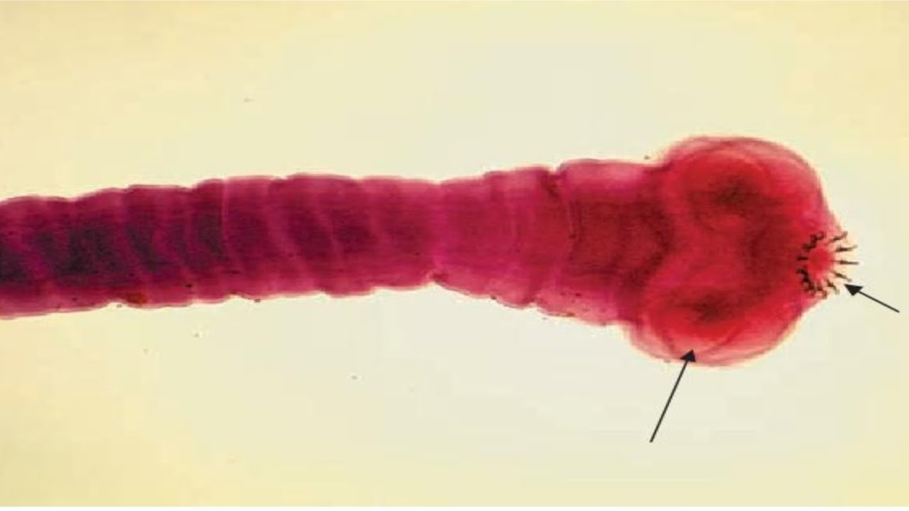 منهج الطفيليات /تحليلات مرحلة رابعة/المحاضرة الاولى /الجزء الثاني والاخير /شرح 2026