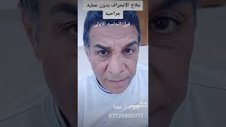 علاج انحراف الأنف بدون عمليه جراحيه للتواصل معنا 009647726900777